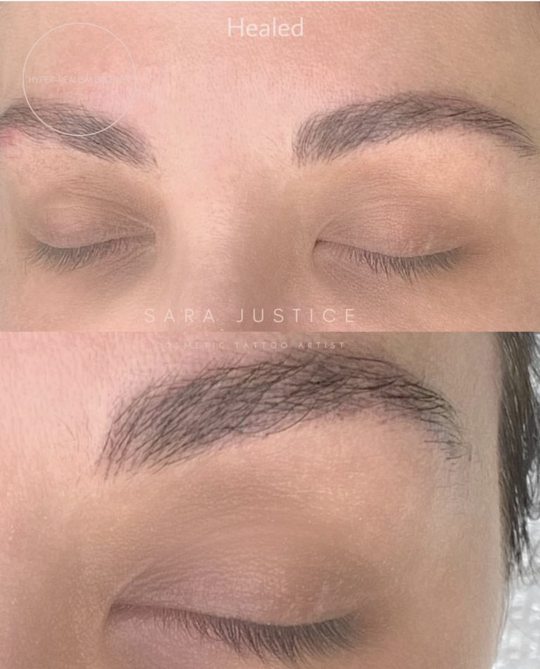 healed brows