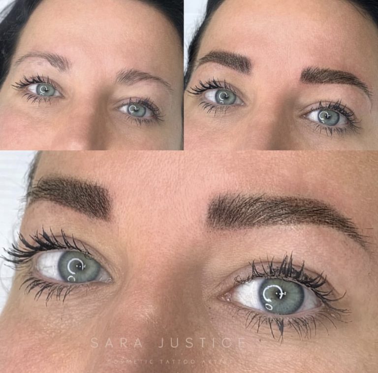 multiple views of restored eyebrows