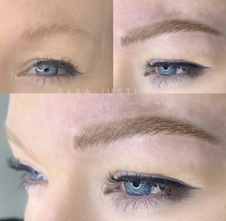 eyebrow restoration