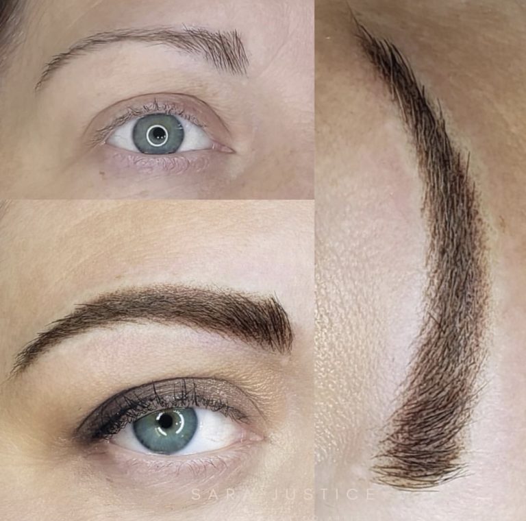 eyebrow restoration example