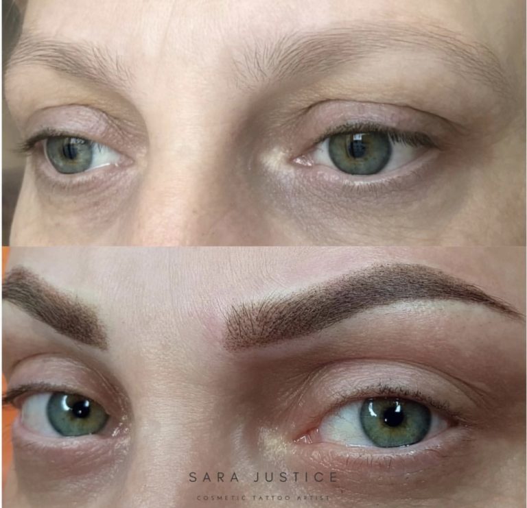 removing signs of age in the eyebrows