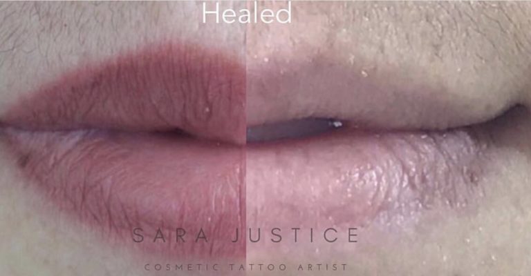 healed lips