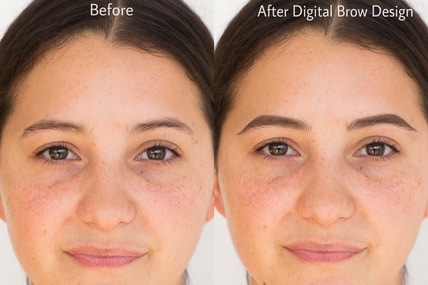 Before and After Digital Brow Design