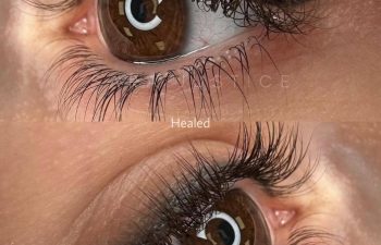 Close-up view of a brown eye with eyelash extensions; top image shows fresh application, bottom image shows healed result after some time.