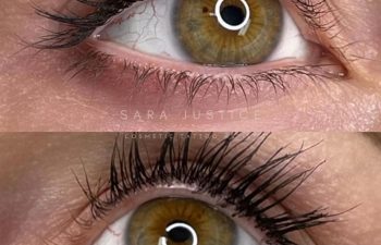 Close-up shots of a hazel eye with visible eyelash enhancement; top image is fresh, bottom image shows healed lash line after over two years.
