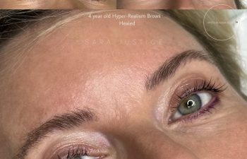 Close-up photos showing a woman's eyebrows before and after receiving "Hyper-Realism Brows" treatment, with healed results visible after four years.