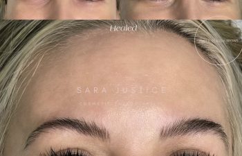 Close-up comparison of a woman's eyebrows before and after cosmetic enhancement, showing fuller and more defined brows in the after image.