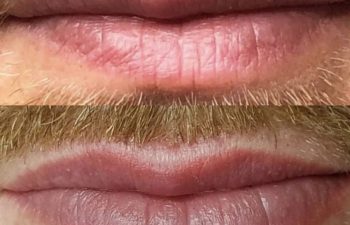 Close-up of a person's lips and mustache shown in two images, one above the other, displaying subtle differences in lip color and texture.