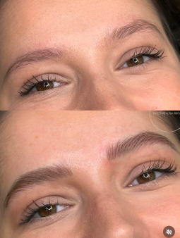 Close-up of a person's eyes, showing sparse eyebrows in the top image and fuller, well-defined eyebrows in the bottom image.
