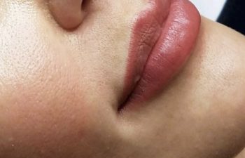 Close-up of a person's face focusing on smooth skin and well-defined, full lips with a natural pinkish-red color.