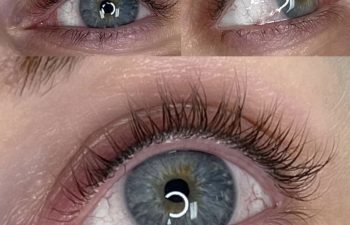 Close-up images of a blue eye with long lashes, shown from different angles. Text at the bottom reads "HEALED 3+ years.