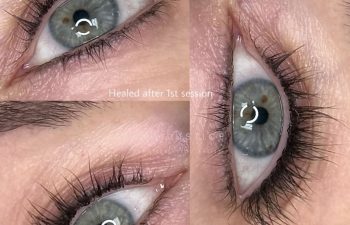 Close-up collage of a blue eye with healed lash enhancement tattoo, showing natural-looking, darker upper lash lines after the first session.