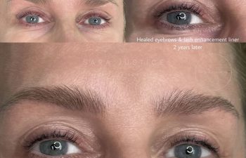 Close-up comparison of a woman's eyes and eyebrows before and after eyebrow and lash enhancement, showing healed results two years later.