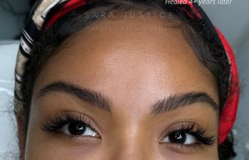 Close-up of a woman's eyebrows before and 4+ years after a cosmetic tattoo, showing fuller, defined brows in the healed image.