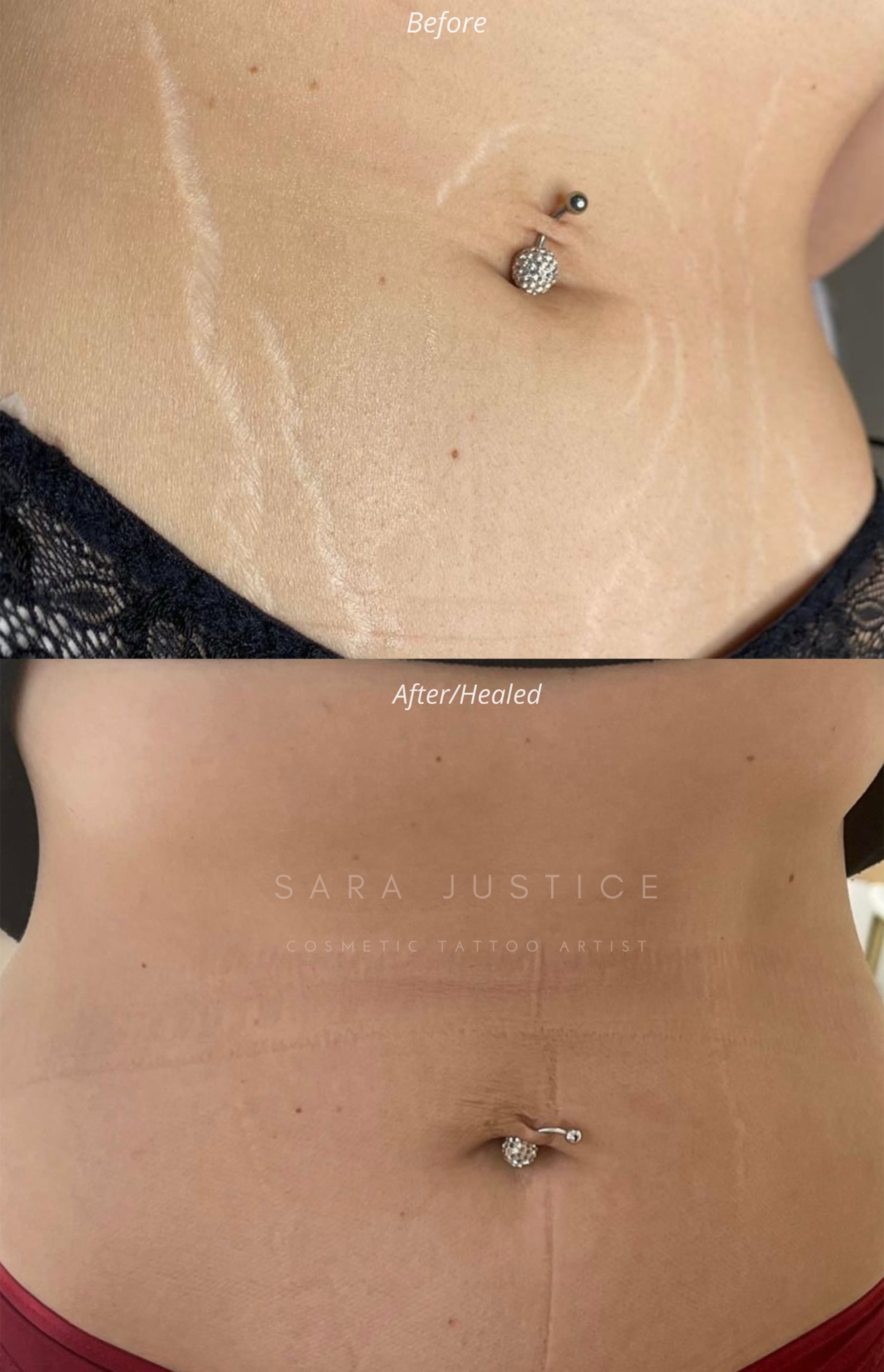 Close-up of a belly with stretch marks and a belly button piercing shown before and after a cosmetic tattoo treatment, highlighting reduced visibility of stretch marks.